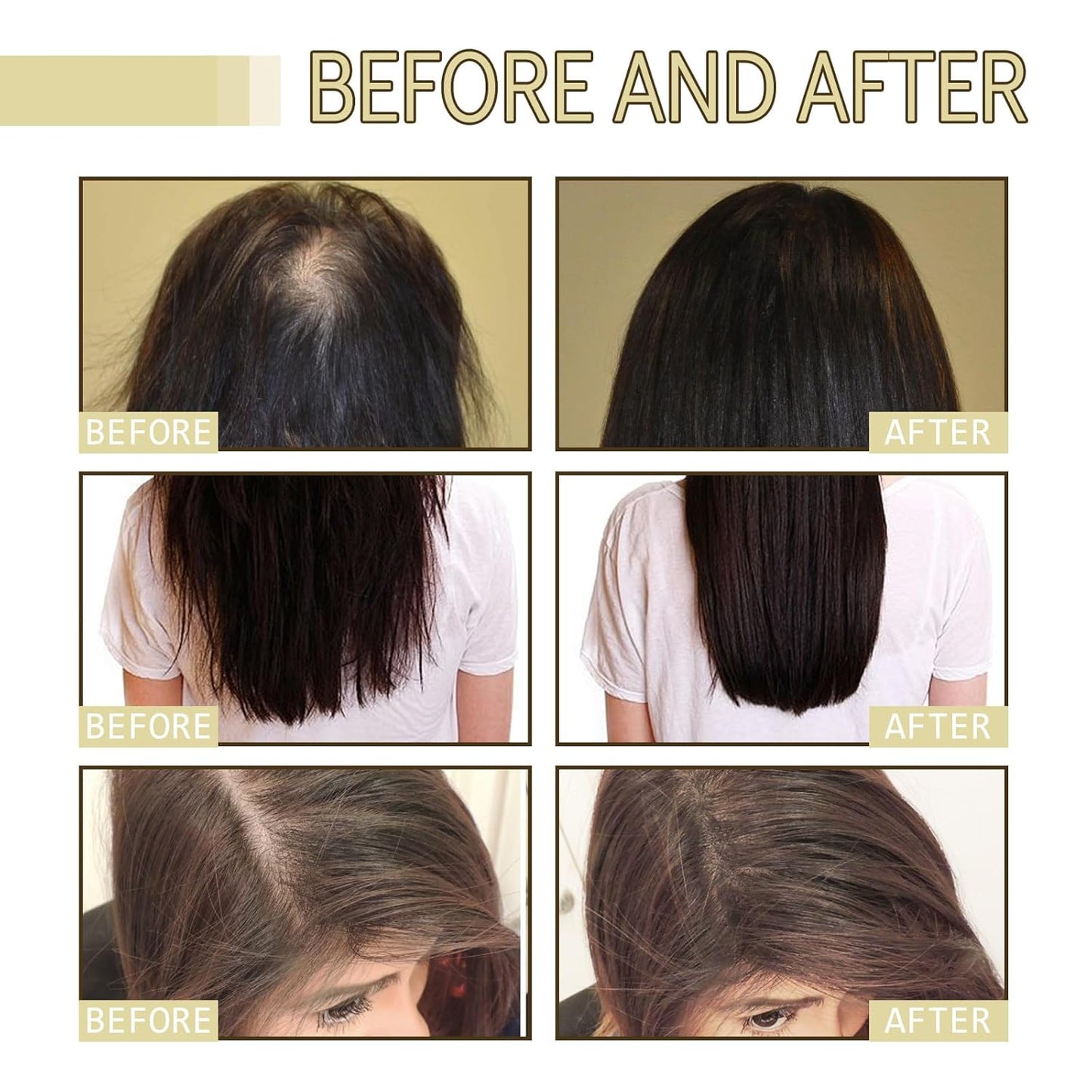 Thrive Locks™ - Hair Growth Oil 