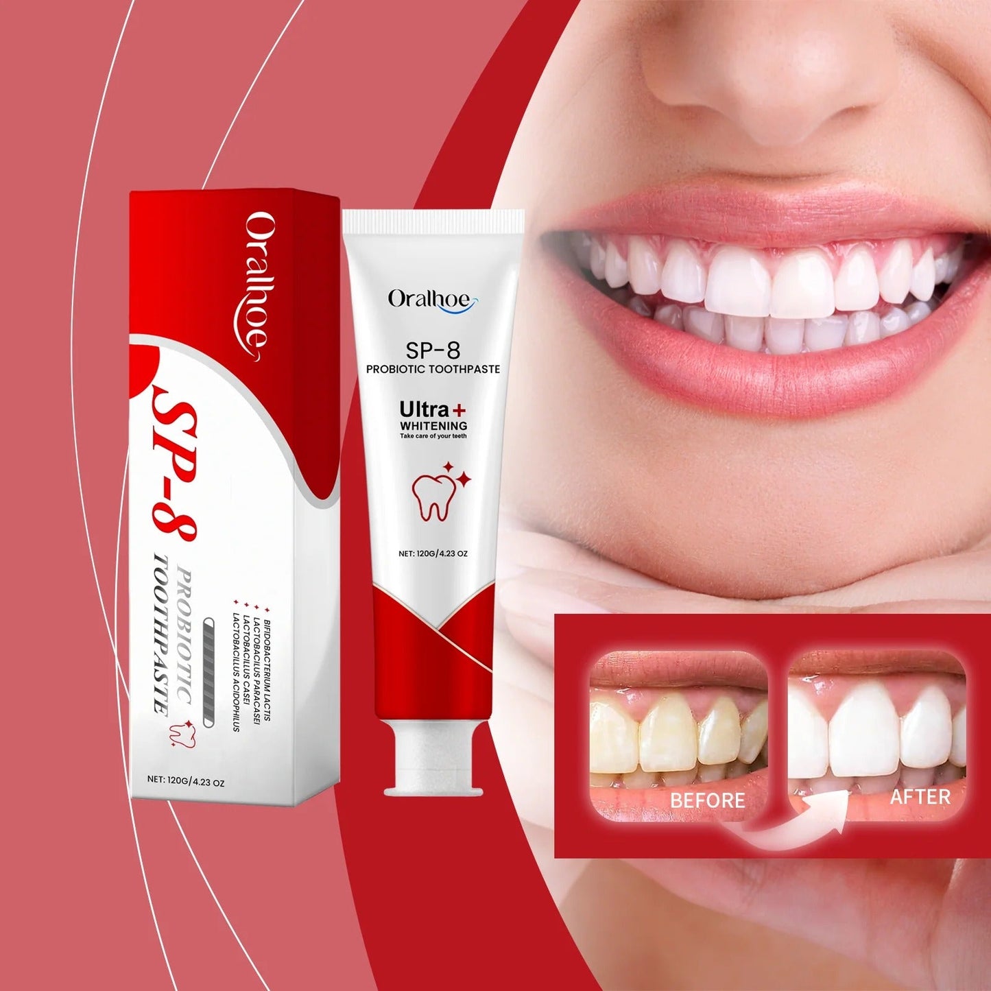 SP-8 Probiotic Toothpaste for Whitening & Deep Cleaning (120g)