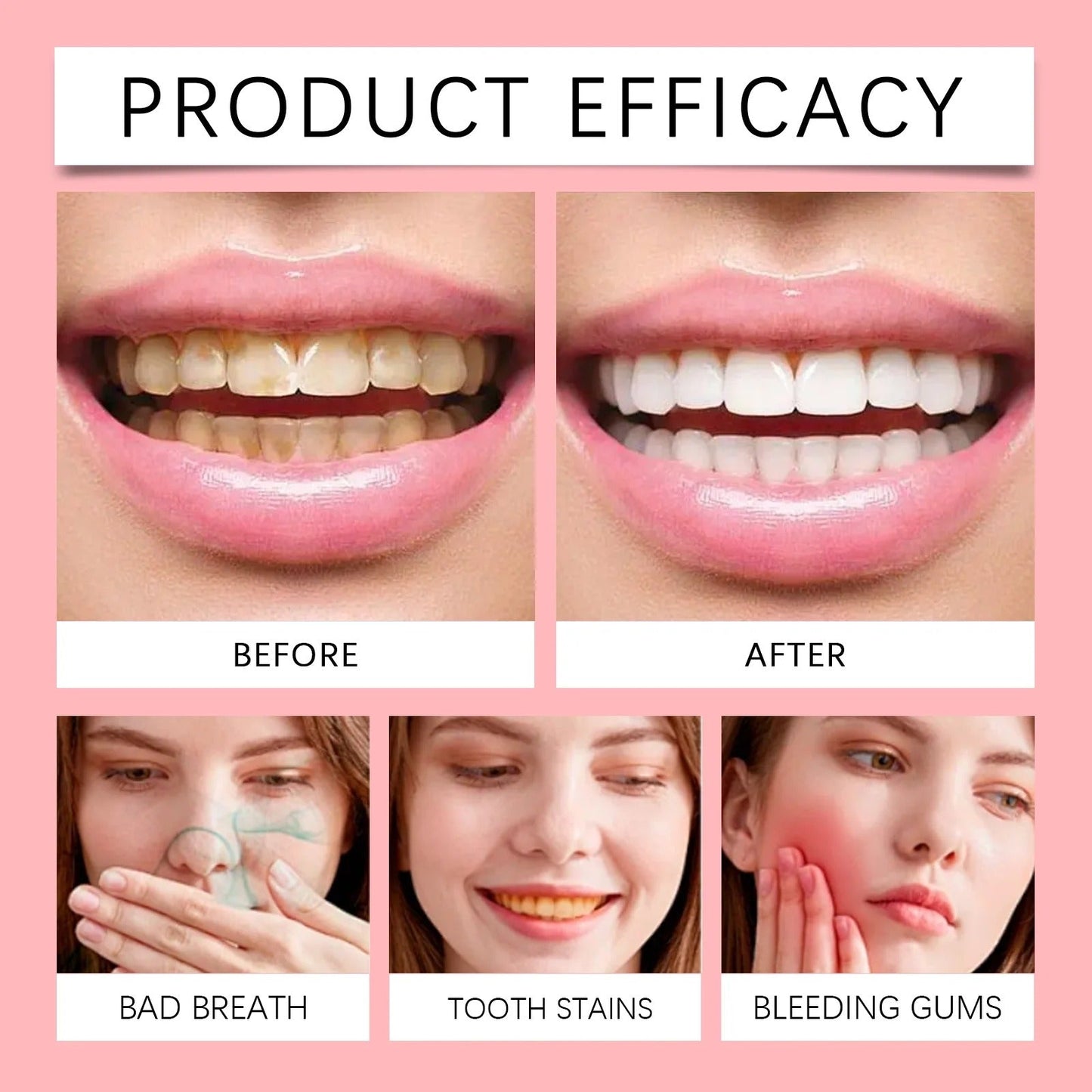 SP-8 Probiotic Toothpaste for Whitening & Deep Cleaning (120g)